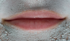 Lips